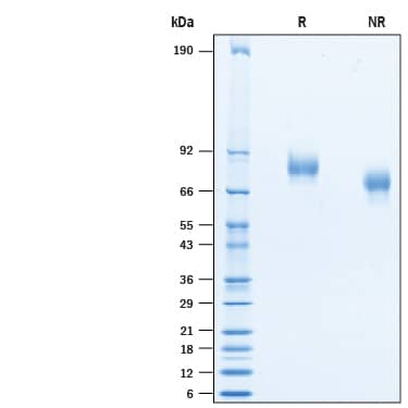 Recombinant Human B7-H3 His-tag Avi-tag Protein SDS-PAGE