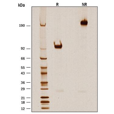 Recombinant Cynomolgus B7-H7/HHLA2 Fc Chimera Protein SDS-PAGE