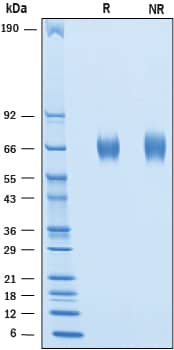 Recombinant Cynomolgus B7-H7/HHLA2 His-tag Protein SDS-PAGE