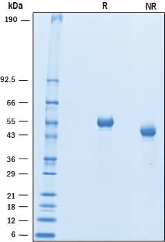 Recombinant Human BACE-2 Protein SDS-PAGE