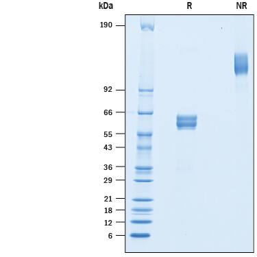 Recombinant Mouse BLAME/SLAMF8 Fc Chimera Protein SDS-PAGE