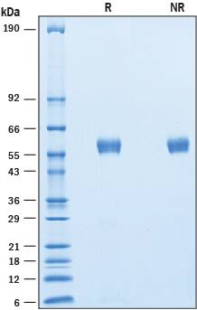 Recombinant Human BPIFB1 His-tag Protein SDS-PAGE