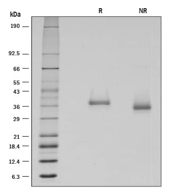 Recombinant Human BTN1A1/Butyrophilin Protein SDS-PAGE