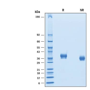 Recombinant Human BTN1A1/Butyrophilin His Avi Protein SDS-PAGE
