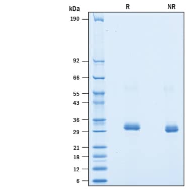 Recombinant Human BTN3A2 His-tag Avi-tag Protein SDS-PAGE