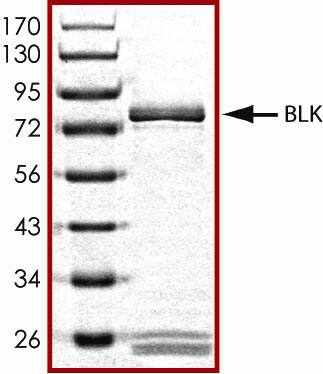 Recombinant Human Active Blk Protein SDS-PAGE