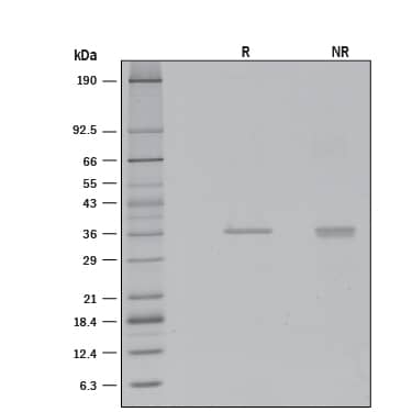 Recombinant Human CTRP4/C1qTNF4 Protein SDS-PAGE