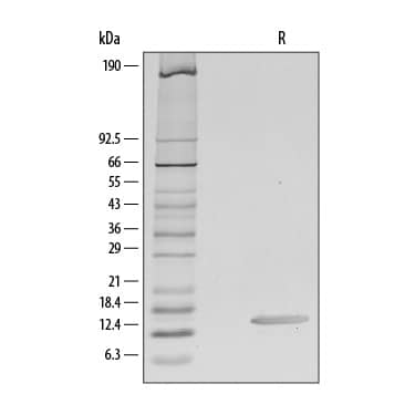 Recombinant Human CCL28 Protein SDS-PAGE
