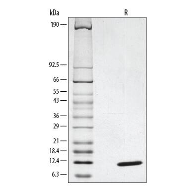 Recombinant Human CCL2/MCP-1 Protein SDS-PAGE