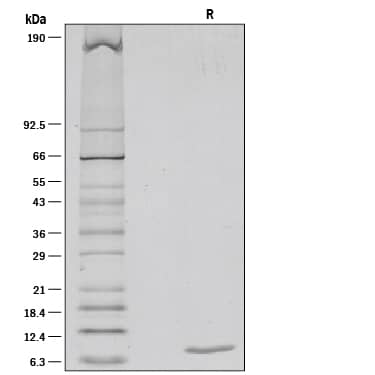 Recombinant Human CCL5/RANTES Protein SDS-PAGE
