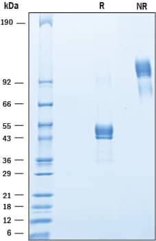 Recombinant Human CD151 Fc Chimera Protein SDS-PAGE