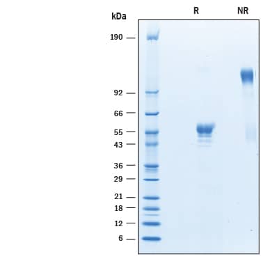 Recombinant Cynomolgus Monkey CD160 Fc Chimera Protein SDS-PAGE