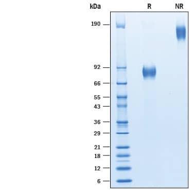 Recombinant Human CD19 Fc Chimera Avi-tag Protein SDS-PAGE