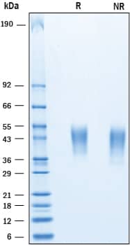 Recombinant Human CD200 His-tag Protein SDS-PAGE
