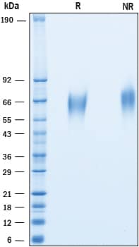 Recombinant Cynomolgus CD200R1 His-tag Protein SDS-PAGE