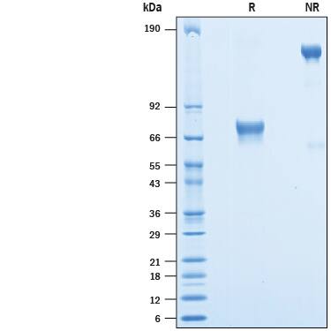Recombinant Human CD25/IL-2R alpha Fc Avi-tag Protein SDS-PAGE