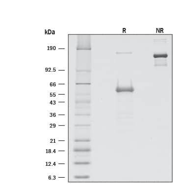 Recombinant Human CD277/BTN3A1 Fc Chimera Protein SDS-PAGE
