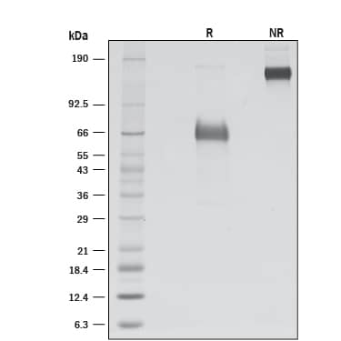 Recombinant Human CD2F-10/SLAMF9 Fc Chimera Protein SDS-PAGE