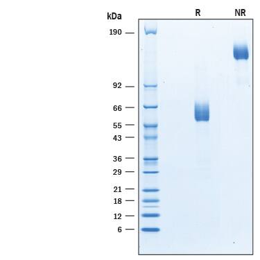 Recombinant Mouse CD300c Fc Chimera Protein SDS-PAGE