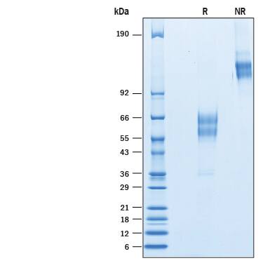 Recombinant Human CD300d Fc Chimera Protein SDS-PAGE