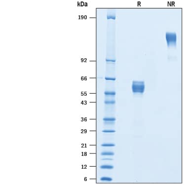 Recombinant Mouse CD300d Fc Chimera Protein SDS-PAGE