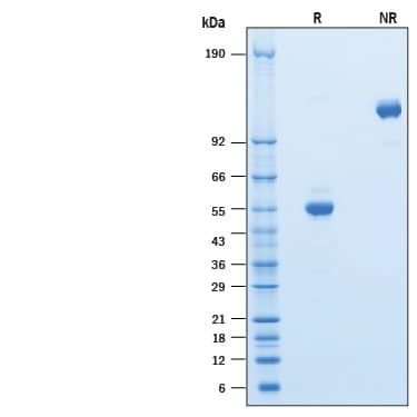 Recombinant Human CD302/CLEC13A Fc Chimera Protein SDS-PAGE