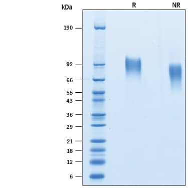 Recombinant Human CD30/TNFRSF8 His-tag Avi-tag Protein SDS-PAGE