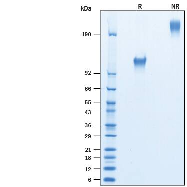 Recombinant Human CD30/TNFRSF8 Fc Avi-tag Protein SDS-PAGE