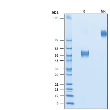 Recombinant Human CD37 Fc Chimera Protein SDS-PAGE