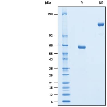Recombinant Human CD40/TNFRSF5 Fc Avi-tag Protein SDS-PAGE