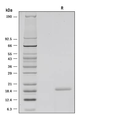 Recombinant Human CD40 Ligand/TNFSF5 (Histidine-tagged) SDS-PAGE