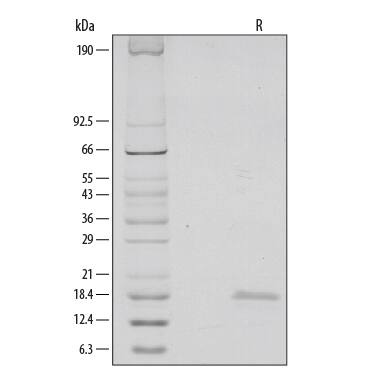 Recombinant Human CD40 Ligand/TNFSF5 (aa 108-261) Protein SDS-PAGE