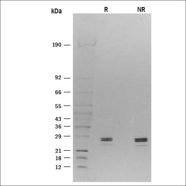 Recombinant Rat CD40 Ligand/TNFSF5 (HA-tag) Protein SDS-PAGE