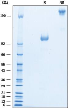 Recombinant Mouse CD43 Fc Chimera Protein SDS-PAGE