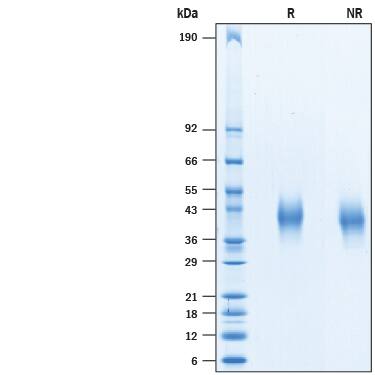 Recombinant Cynomolgus CD48/SLAMF2 His-tag Protein SDS-PAGE