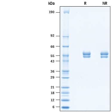 Recombinant Mouse CD4 His-tag Protein SDS-PAGE