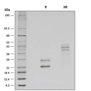 Recombinant Human CD69 Protein SDS-PAGE