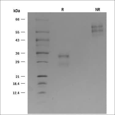 Recombinant Mouse CD69 Protein SDS-PAGE