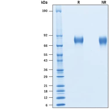 Recombinant Cynomolgus CD6 His-tag Protein SDS-PAGE