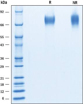 Recombinant Mouse CD6 His Tagged Protein SDS-PAGE