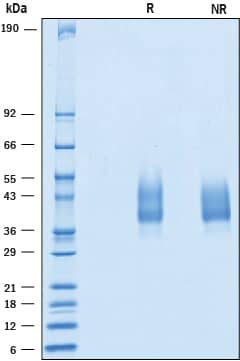 Recombinant Human CD79A Protein SDS-PAGE