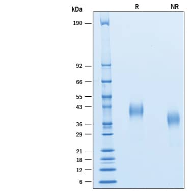 Recombinant Cynomolgus Monkey CD7 His-tag Protein SDS-PAGE