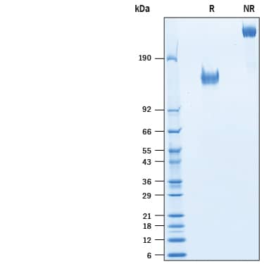 Recombinant Rat CD96 Fc Chimera Protein SDS-PAGE