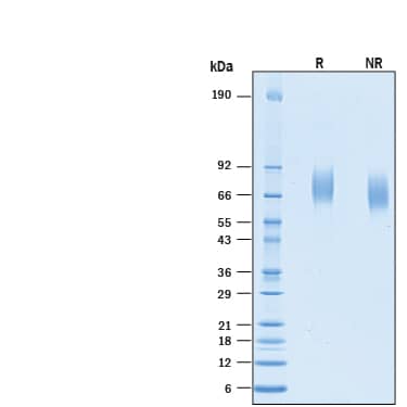 Recombinant Human CD97 His-tag Protein SDS-PAGE