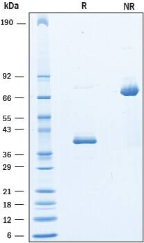 Recombinant Human CD9-LEL Fc Chimera Protein SDS-PAGE