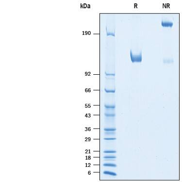 Recombinant Human CDCP1 Fc Chimera Protein SDS-PAGE