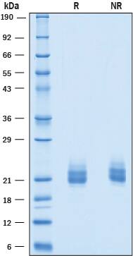Recombinant Human CEACAM-3/CD66d His-tag Protein SDS-PAGE