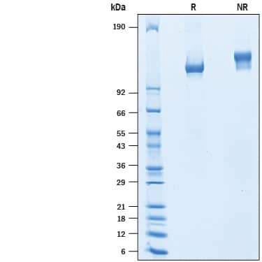 Recombinant Mouse CEACAM-5/CD66e His-tag Protein SDS-PAGE