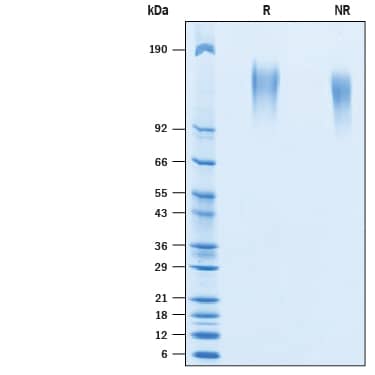 Recombinant Human CEACAM-5/CD66e His-tag Avi-tag Protein SDS-PAGE
