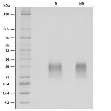 Recombinant Human CLEC-2A Protein SDS-PAGE